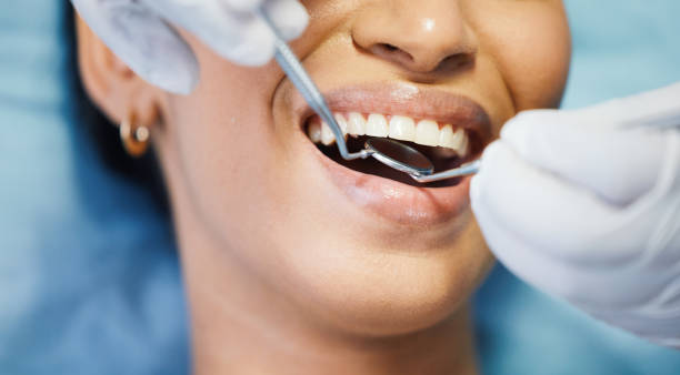 Best Emergency Cosmetic Dentistry (e.g., broken veneers) in Federal Heights, CO